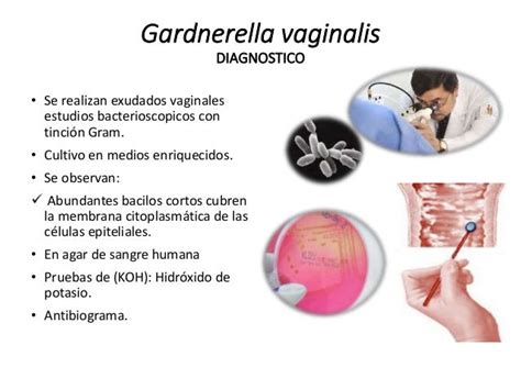 gardnerella sintomas